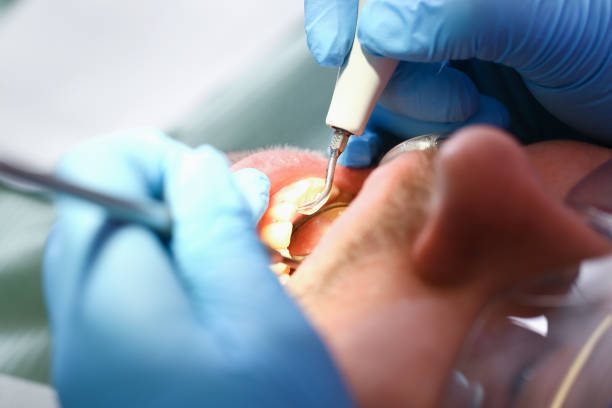 Best Emergency Root Canal Treatment in Kirbyville, TX